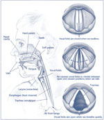 hoarseness from singing